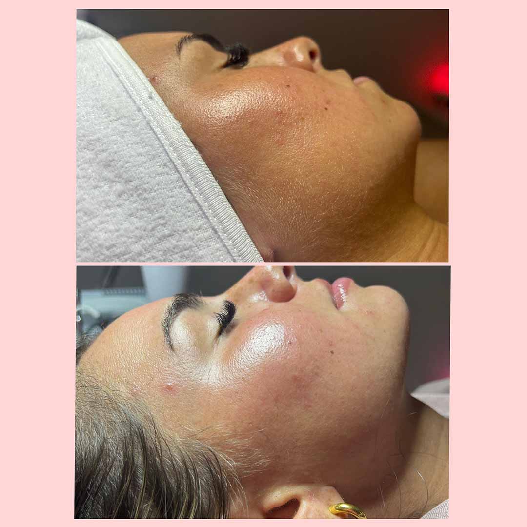 client