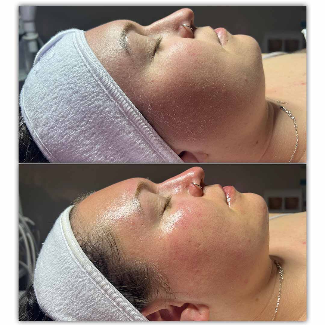 client
