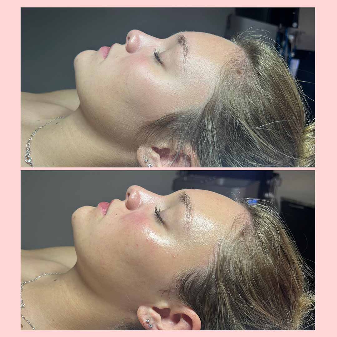 client