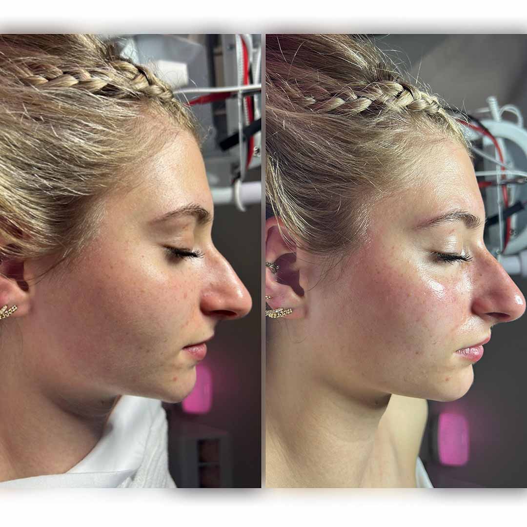 client