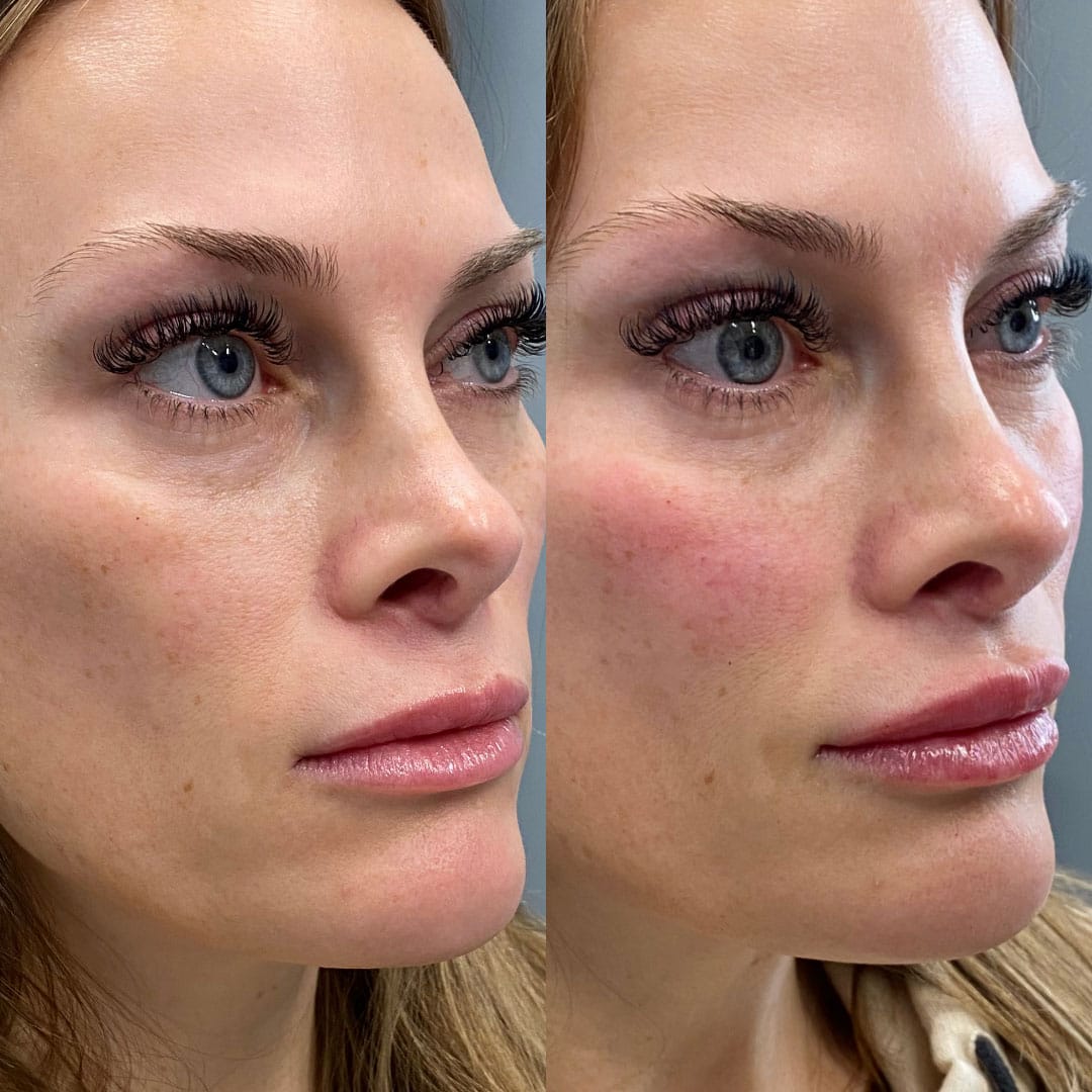 client