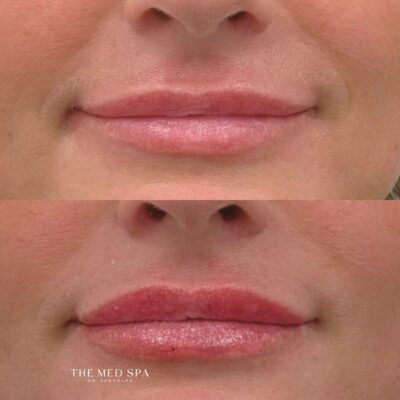 Before and Afters website (1)