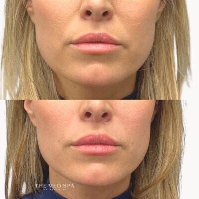 Before and Afters website