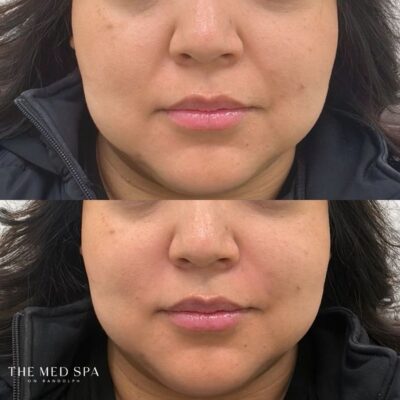 Before and Afters website - 3