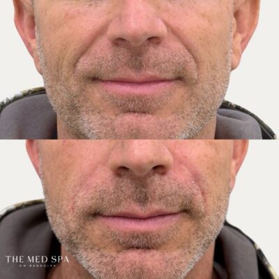Before and Afters website - 2