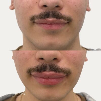 Facetune_20-05-2026-13-25-27